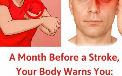 As you probably know, prompt treatment of a stroke patient has a huge impact on their survival. For this reason, it is important to raise public awareness of what a stroke is and what its symptoms are.  what is a stroke?  A stroke occurs when blood flow to the brain is interrupted and it is deprived of oxygen. The consequences can therefore be extremely serious, even fatal. There can be different types:  Ischemic stroke is the most common. It occurs when a blood clot or cholesterol plaque blocks an artery (this is called an embolism or thrombosis). Hemorrhagic stroke is a less common case. It is a hemorrhage in the brain caused by a ruptured aneurysm, a tumor, an accident, a circulatory disorder, etc.  Transient ischemic attack, finally, is the obstruction of an artery that resolves itself after a few moments. Unfortunately, some people confuse TIA with a simple malaise because of this.  Continued on next page:  The signs to notice can vary depending on the area of ​​the brain that is affected. This can range from a deformed mouth to sudden blindness, speech problems or weakness in a part of the body.  ACCORDING TO DOCTORS, 10 SYMPTOMS COULD BE WARNING SIGNS A FEW WEEKS BEFORE A STROKE.  Some of these symptoms would already occur, to a lesser extent, a few weeks or months before a stroke. This is particularly the case with memory loss.  So you have to be very attentive to the signs and take care of your body. Eating healthy, controlling your cholesterol, limiting alcohol and tobacco consumption are just some of the factors that can limit the risk of stroke.  Visual, auditory and olfactory hallucinations should be taken very seriously. Exhaustion Facial paralysis  Continued on next page:    Tunnel vision: Loss of peripheral vision can be worrisome. Loss of coordination: If your movements become uncoordinated, contact your doctor immediately. Speech difficulties: If you have difficulty speaking and communicating, it is essential to call an ambulance. Headaches: If you don’t have migraines, this is a symptom to be aware of. Sudden increases in blood pressure are a serious signal to anticipate. Survival from a stroke depends on the speed of intervention, so these symptoms are essential to recognize.And, when in doubt, never hesitate to call emergency services.